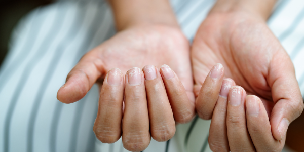 The Ultimate Solution for Brittle Nails: Say Goodbye to Weakness