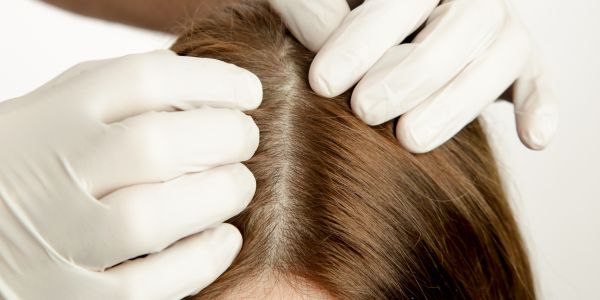 Healthy Scalp: The Key to Hair Growth